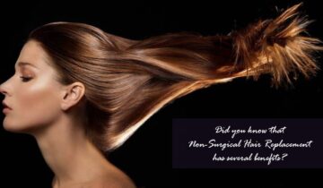 How exactly does Non-Surgical Hair Replacement Work?